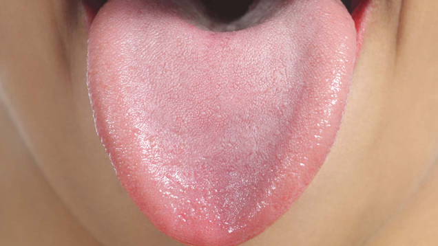 Illustration for article titled Live A Little! Press Your Tongue Against These 10 Pictures Of Tongues